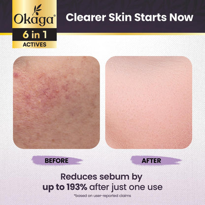 Black Rice Peel Shot Ampoule Exfoliator for Face